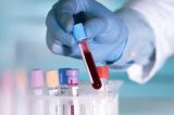 Universidade brasileira cria exame de sangue que fica pronto em 5 segundos