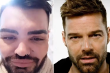 Fã obcecado que gastou R$ 5,5 milhões para ficar ‘parecido’ com Ricky Martin diz se arrepender de cirurgias e lamenta não alcançar o objetivo