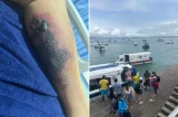 Turista morre após ser picado por aranha-marrom em Morro de São Paulo