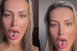 Andressa Urach reclama de dor após procedimento na língua: “Difícil”