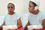 Mulher tem rosto rasgado com golpes de facão pelo ‘ex’ na Bahia