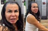 Gretchen surge sem prótese capilar: ‘Perdi todo o cabelo’