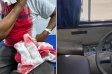 Motorista de ônibus é agredido com pedrada após negar carona a passageiro em Salvador