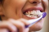Anvisa alerta para uso de creme dental com fluoreto de estanho