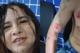 Mulher se revolta ao flagrar traição e morde marido e amante: ‘Agora que surtei tá achando ruim’
