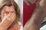 Professora idosa é espancada por cobrar dever de casa de aluno