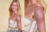 Maria Ruy Barbosa explica hematomas em Cannes