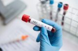 Estigma do HIV persiste como barreira ao tratamento e à dignidade humana, aponta Unaids