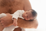 Bebê de 10 meses sofre alterações na genitália após contato com gel de testosterona do pai