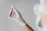 HIV na Bahia: SESAB desmente surto em jovens e apresenta dados