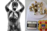 Preso é flagrado com maconha no intestino em presídio na Bahia
