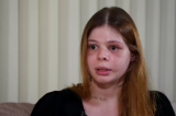 Médica que teve rosto desfigurado pelo namorado fala sobre ataque que sofreu no dia em que fez aniversário