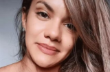 Mulher agredida com 61 socos: “As cicatrizes só deverão passar totalmente um ano depois da cirurgia” Mulher agredida com 61 socos: “As cicatrizes só deverão passar totalmente um ano depois da cirurgia”
