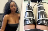 Adolescente amputa pernas e dedos após confundir doença com gripe: ‘Pés verdes’