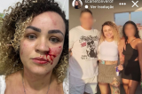 Blogueira denuncia agressão de ex-companheiro e amiga pelas redes sociais