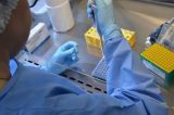 Brasil tem 17 casos confirmados de intoxicação por metanol