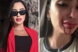 Ex-dançarina do Faustão pede ajuda após ser atacada com facada no rosto pela própria mãe