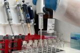Metanol: casos suspeitos de intoxicação em Pernambuco sobem para 26; SES-PE investiga 4 mortes