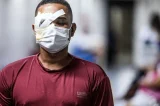 Ex-secretário é intimado a depor em processo de PM acusado de atirar e cegar trabalhador no Recife