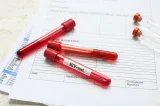 40 mil novos casos de HIV no Brasil por ano: saiba como se prevenir