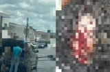 Subcomandante da Brigada Águia Resgate é atacado a facão na Bahia