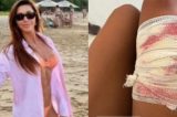 Reviravolta em Noronha: Vídeo mostra que tubarão foi surpreendido por salto de advogada