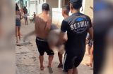 Morre adolescente mordido por tubarão em Olinda: ‘Lesão bastante extensa, num local de artérias’, diz médico