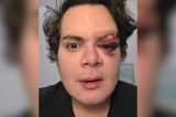 Médico agredido em casa no Recife teme pela vida com agressor em liberdade: “A gente está à mercê”