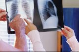 Doença pulmonar obstrutiva crônica acomete mais os idosos, diz pneumologista
