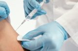 Botox anal: procedimento promove relaxamento muscular e aumento de prazer sexual