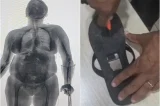 Idosa tenta entrar em presídio com drogas e eletrônicos escondidos em muleta e chinelo