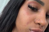 VÍDEO: Influenciadora baiana denuncia agressões do marido e faz apelo por socorro