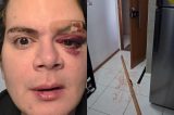 “Tenho medo que ele volte mais agressivo”, diz médico agredido por vizinho no Recife