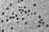 Sesab confirma dois casos de Mpox na Bahia em 2026