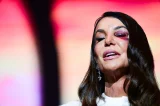 Ivete Sangalo detalha acidente doméstico após desmaio e ida ao hospital: ‘Caí e bati a cabeça no chão’