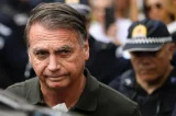 PF diz que foram encontradas alterações neurológicas em exame de Bolsonaro