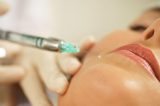 Anvisa alerta para riscos de uso indevido de preenchedores dérmicos