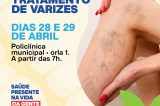 Prefeitura de Juazeiro realiza mutirão inédito para tratamento de varizes