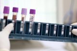 Bahia já tem pontos de coleta para exame genético de doenças raras no SUS