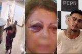 Homem é preso após pular balcão e espancar brutalmente recepcionista de hotel por ela recusar beijo; ASSISTA