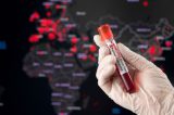 Mpox avança no Brasil e coloca oito estados em alerta máximo; saiba quais