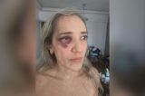 Passageira é agredida por motociclista de app após reclamar de capacete sem viseira