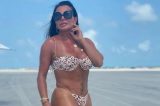 Gretchen choca ao detalhar cirurgia íntima: “Ela tá sorrindo”