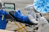 Você pode estar com hantavírus pensando que é gripe; entenda os sintomas