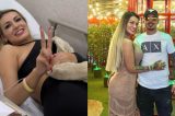 “Meu marido ficou sem acreditar”: Andressa Urach abre o jogo sobre cirurgia íntima