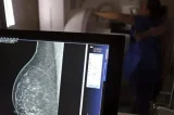 Teste genético que prevê risco de câncer de mama será feito no SUS Teste genético que prevê risco de câncer de mama será feito no SUS