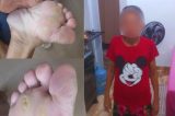 Sem assistência, mulher que foi resgatada de trabalho escravo pede para voltar à casa dos patrões no Recife