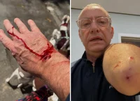 Apresentador da Globo é atacado por pitbull: ‘Ele avançou e feriu a mim e a uma das minhas cachorras’ Apresentador da Globo é atacado por pitbull: ‘Ele avançou e feriu a mim e a uma das minhas cachorras’