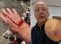 Apresentador da Globo é atacado por pitbull: ‘Ele avançou e feriu a mim e a uma das minhas cachorras’
