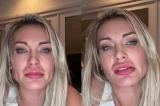 VÍDEO: Andressa Urach revela coceira em parte íntima após uso de medicamento contra doença sem cura: “Achei estranho”